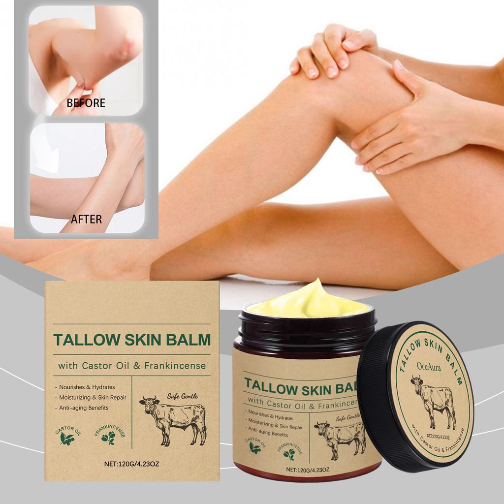 Die Rindertalg-Feuchtigkeitscreme spendet tiefenwirksam Feuchtigkeit und schließt sie ein, reduziert Trockenheit und Empfindlichkeit und bietet eine angenehme Pflege für die Haut.