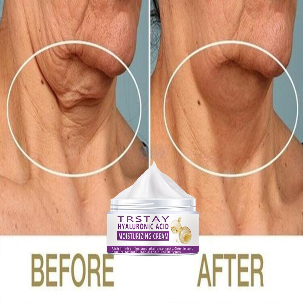 Anti-Wrinkle Serum Whitening Firming Cream Anti-Aging Cream Brysthals og ansikt