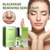 Ouhoe Blackhead Removal Essence Set - Cleanses Pores, Refines Skin, Controls Oil, Repairs Acne, Blackheads, And Nose Strips