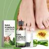 Toenail TreatmentExtra Strong, NailTreatment, Nail TreatmentExtra Strong For Thick, Discolored And Damaged Nails,30ml