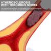 Pvc Cardiovascular Model Science Atherosclerosis Display Hospital Teaching Supplies Anatomical Models Physiology