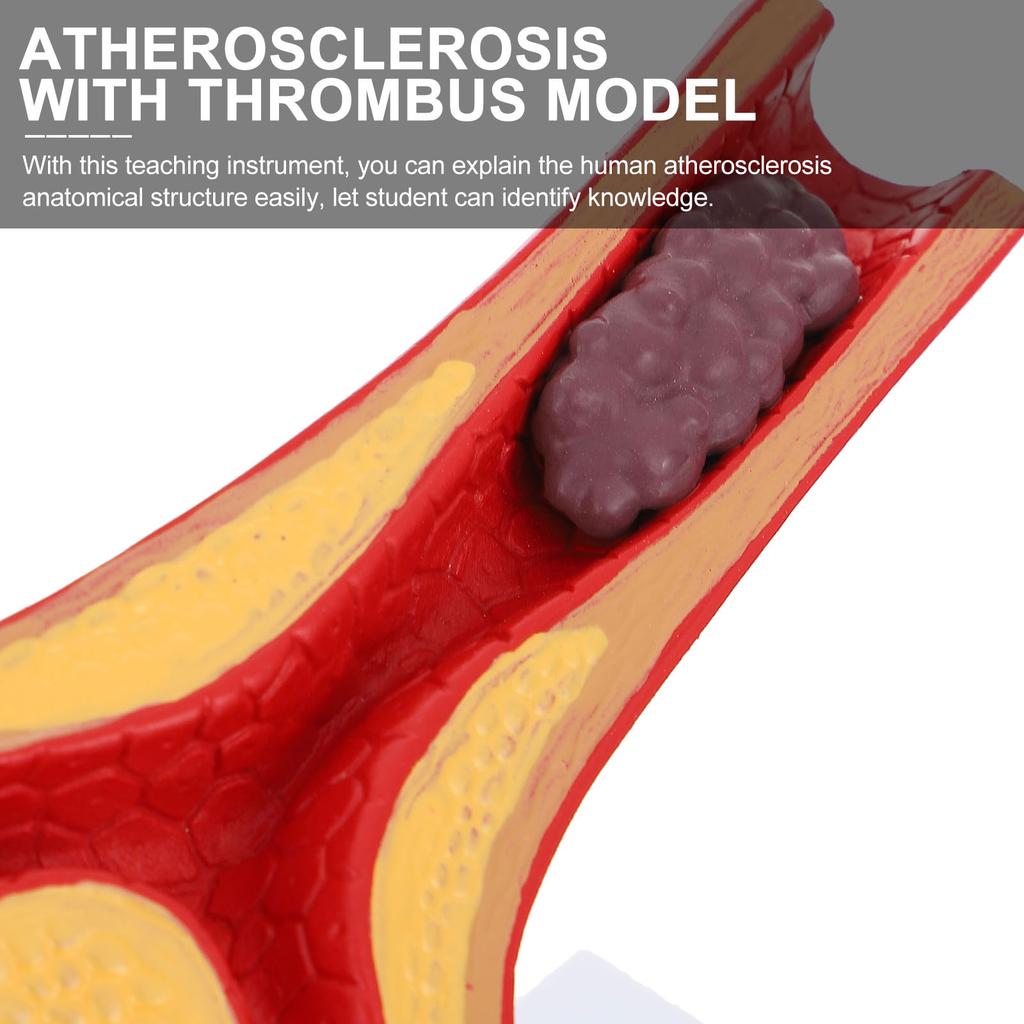 Pvc Cardiovascular Model Science Atherosclerosis Display Hospital Teaching Supplies Anatomical Models Physiology