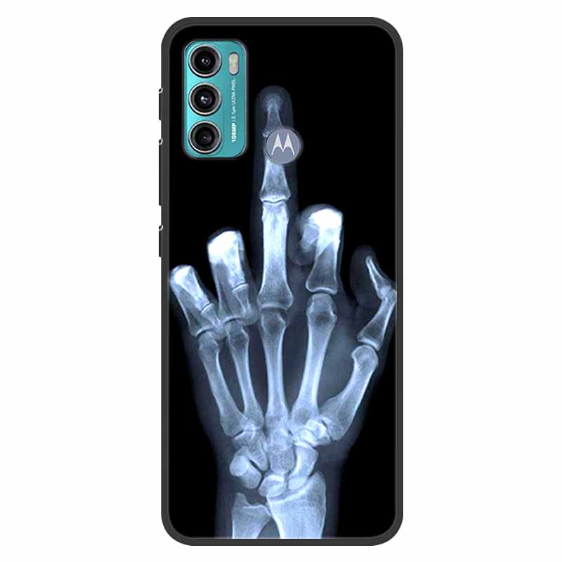 For Motoroal Moto G60 Case Shockproof Soft silicone TPU Back Cover For Moto G60S G 60 Phone Cases for Motorola G60 Cute Cartoon