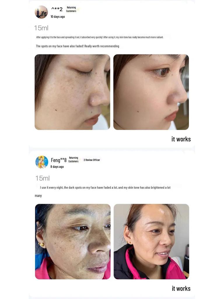 Han Bei Dan White Oil - Whitening & Freckle Removal Essence