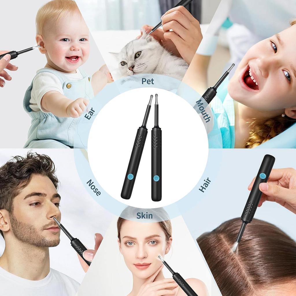Ear Wax Removal, Ear Wax Removal Tool with 1080P HD Camera and 6 LED Lights, Ear Wax Removal Kit for iOS and Android (Black)