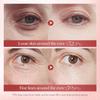 Eye Cream Instant Wrinkle Remove Snail Essence Remove Fine Lines Eye Bags Anti Dark Circle Puffiness Moisturize Firming Eye Care