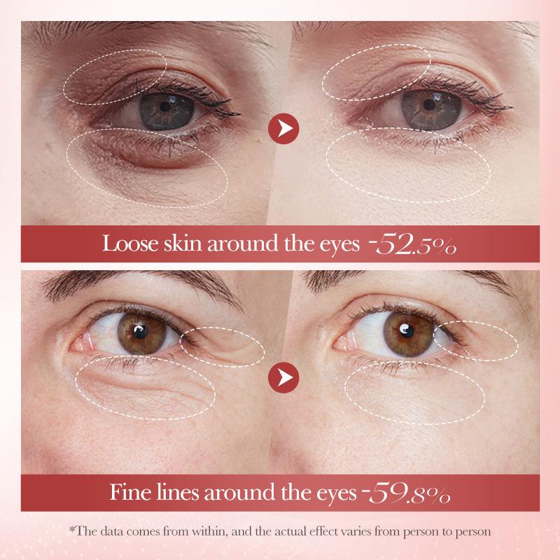 Eye Cream Instant Wrinkle Remove Snail Essence Remove Fine Lines Eye Bags Anti Dark Circle Puffiness Moisturize Firming Eye Care