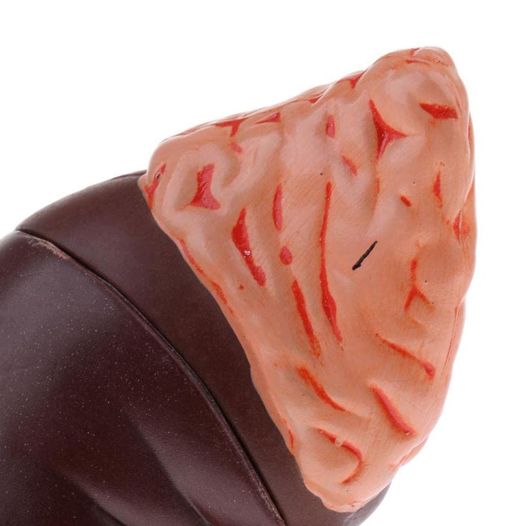 Kidney Model Anatomy Normal Human Anatomical Teaching Doctors Office Educational Tool