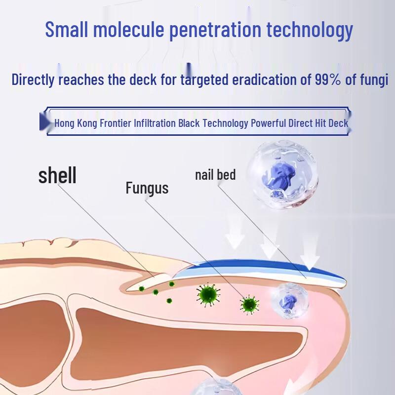Jingpeitang Onychomycosis Nail Repair Solution