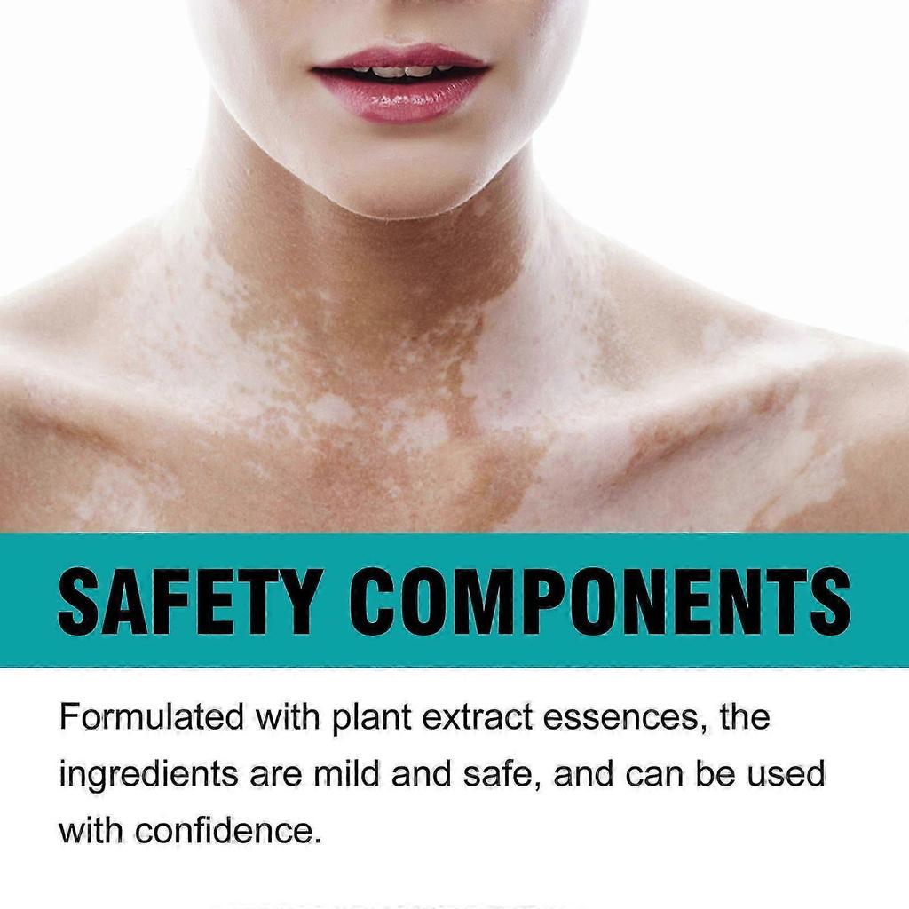 Vitiligo Fix Elixir - Revitalizing Cream for Even Skin Tone & Spot Lightening, 15g!xx2