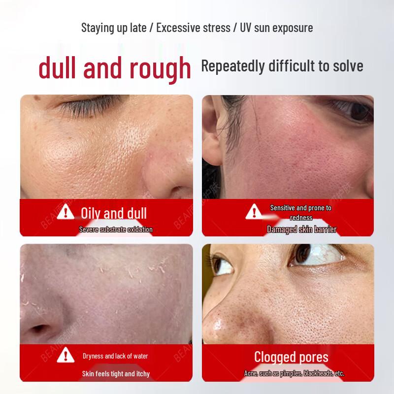 BEAI 6% Niacinamide Glycerin Facial Essence