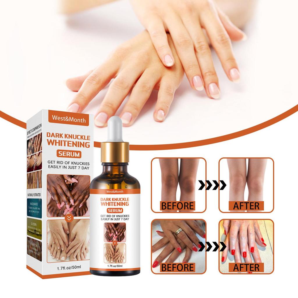 50ml Skin Beauty De-Tanning Serum Brighten Skin Tone Knee & Ankle Corner De-Marker Moisturizing Serum