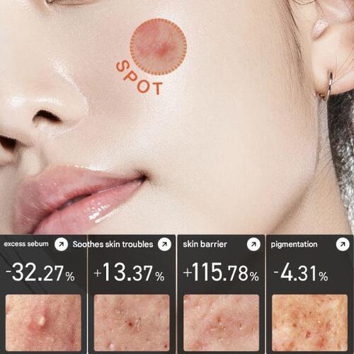 Anua Heartleaf Centella Red Spot Cream 30g