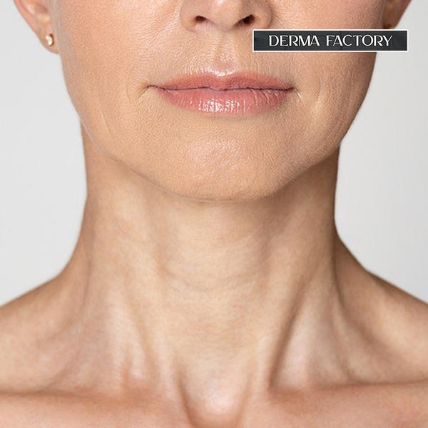 [DERMA FACTORY] Vegan Certified NMN 1% Renewing Serum 30ml