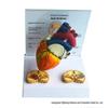 Atrial Fibrillation PVC Heart and Brain Anatomical Teaching Model for Medical Research