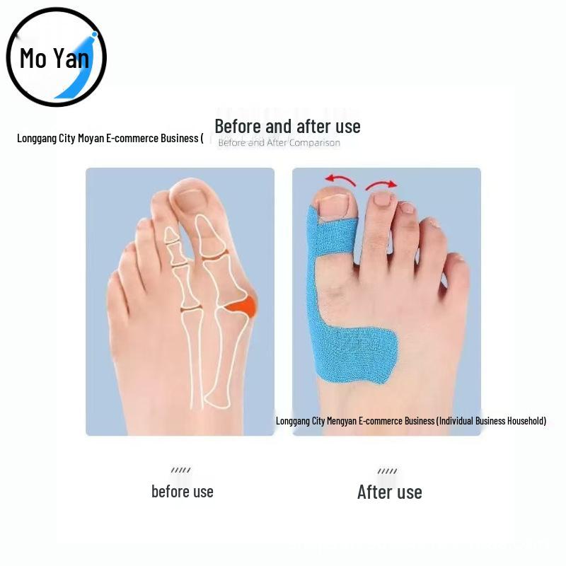 

Waterproof Anti-Friction Toe Stickers: Comfortable, Breathable, Non-Slip, Strong Adhesion Foot Protection 1 Toe Sticker (Unpackaged) чёрный