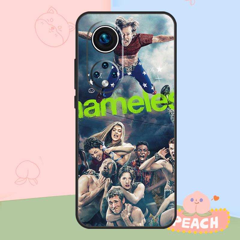 Shameless TV Series Case For Honor Magic 8 Pro 5 6 7 Lite Honor Win RT 400 200 50 70 90 X8c X9a X9b X9c X9d Cover