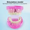Dental Implant Model Teaching Aid for Dentist Student School Removable Teeth Orthodontic Demo Models Dental Prosthetic Demonstration