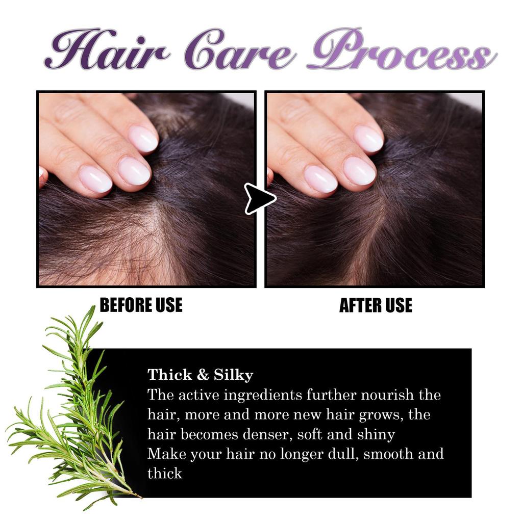 EELHOE Spray capillaire oignon romarin Hydratation profonde Cuir chevelu Lisse & Brillant Spray revitalisant pour cheveux