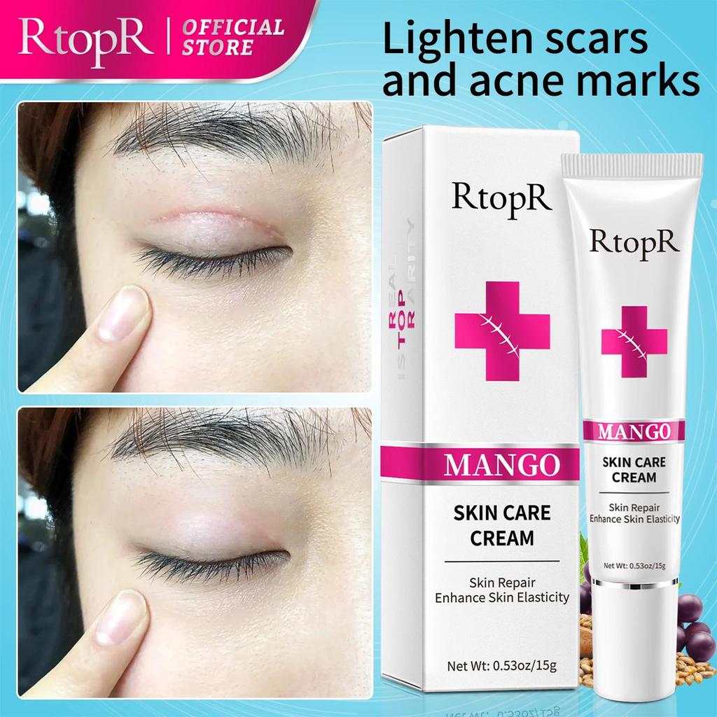 RtopR Acne Removal Cream Skin Repair Face Cream Acne Spots Acne Blackhead Whitening Cream