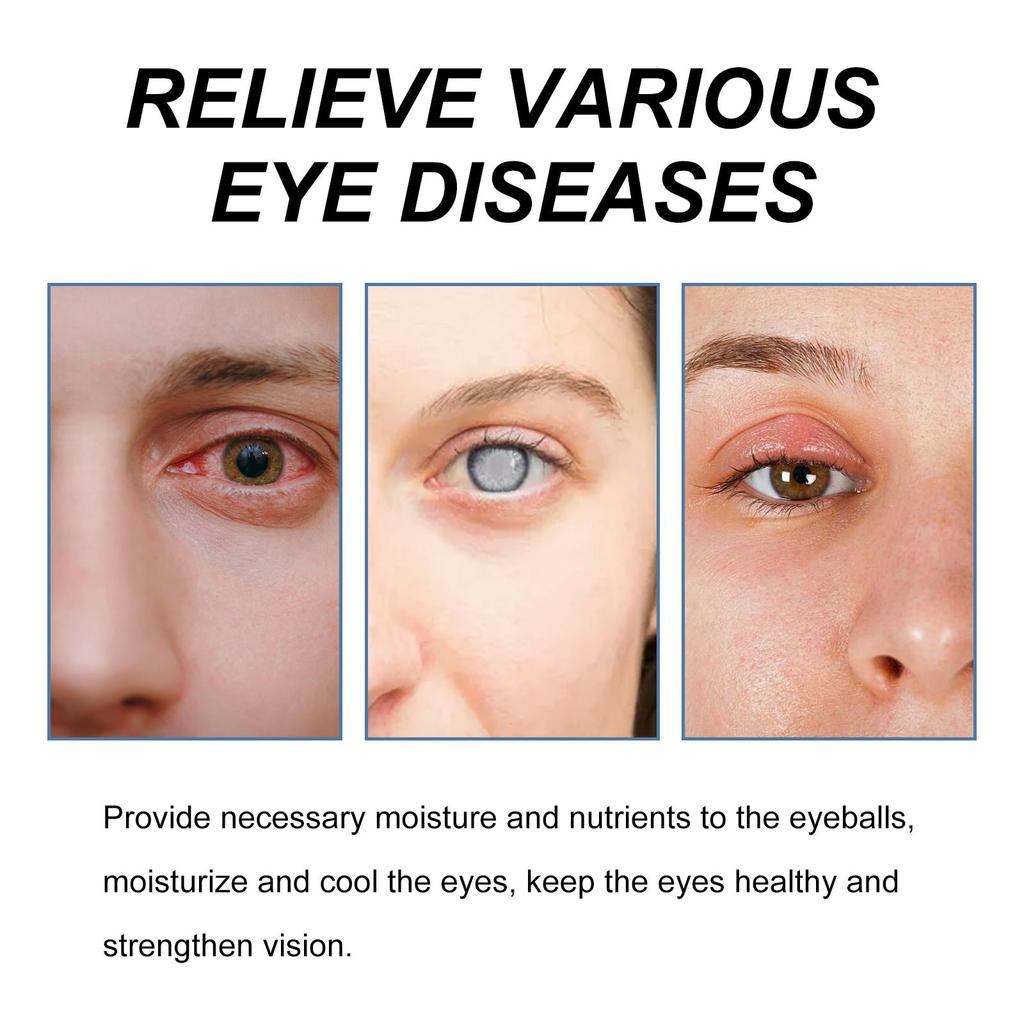 1.8ml*10pcs Eye Drops Relieve Eye Discomfort Repair Eye Fatigue Dryness Blurred Vision Moisturizing Eye Care Solution