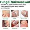 Eelhoe Nail Care Solution For Fungal Toenail Treatment With Nourishing Moisture