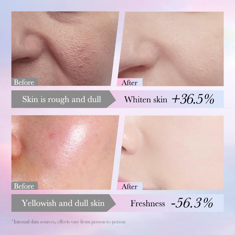 Sadoer Niacinamid Hautaufhellende Reparatur-Lotion für strahlende Haut und Fleckenbehandlung