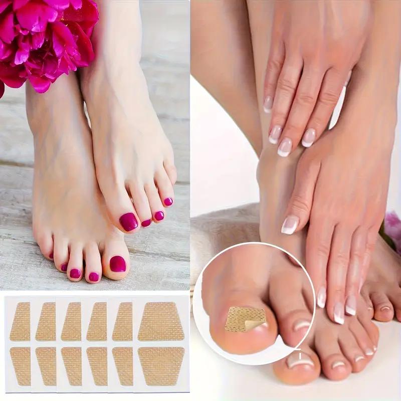 Adesivo Corretor de Unha Encravada Sem Cola - Adesivo para Reparo de Unha para Correção de Sulco e Leito Ungueal