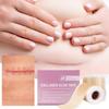 Scar Sheets 1 Roll Self-Adhesive Scar Cover Tape Skin Care Waterproof and Breathable