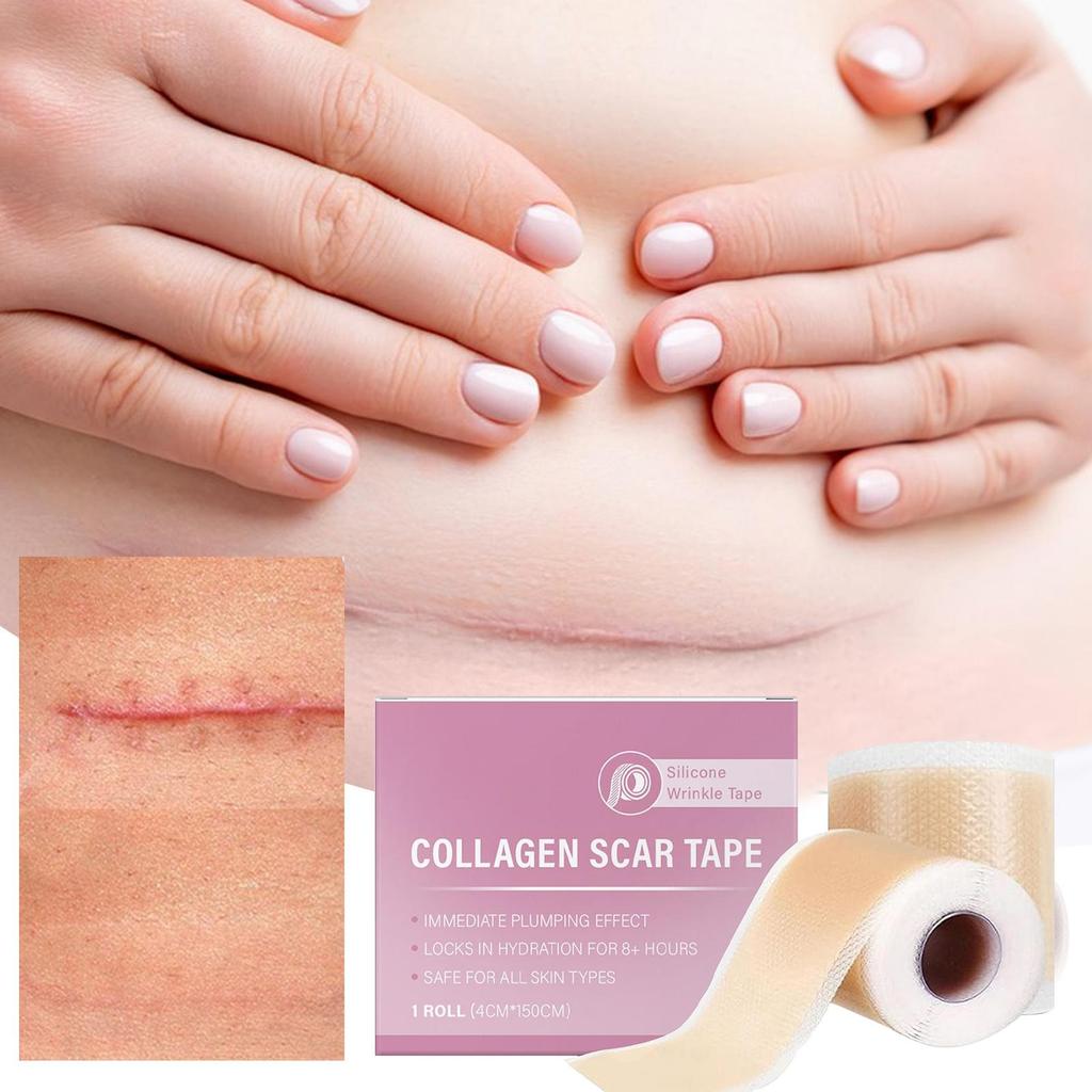 Scar Sheets 1 Roll Self-Adhesive Scar Cover Tape Skin Care Waterproof and Breathable