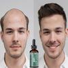 Hızlı Uzayan Saç Dökülmesi Bakım Ürünü Erkek Saç Büyüme Özü Kalınlaştırıcı