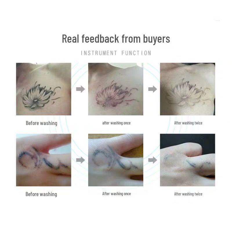 Portable Picosecond Laser Pen for Tattoo, Freckle, and Eyebrow Removal with Red & Blue Light