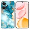 For Honor 400 5G (Global) Case Marble Pattern Printing Soft TPU Phone Cover