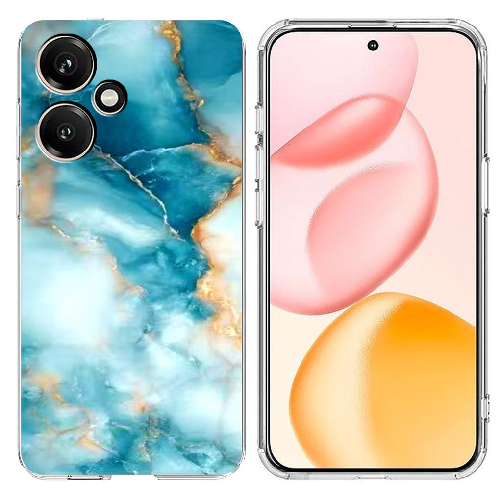 For Honor 400 5G (Global) Case Marble Pattern Printing Soft TPU Phone Cover