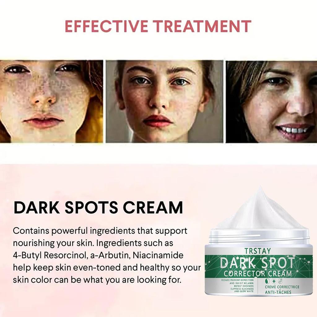 TRSTAY Vitamina C per Crema Viso Pigmenti Rimozione Macchie Scure Crema Viso Sbiancante Prodotti per la Cura della Pelle Schiarente Bellezza Salute