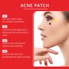 Jaysuing Acne Patches: Top-quality Hydrogel Acne Patches Designed Specifically To Reduce Acne and Whiteheads, 200 Pieces.