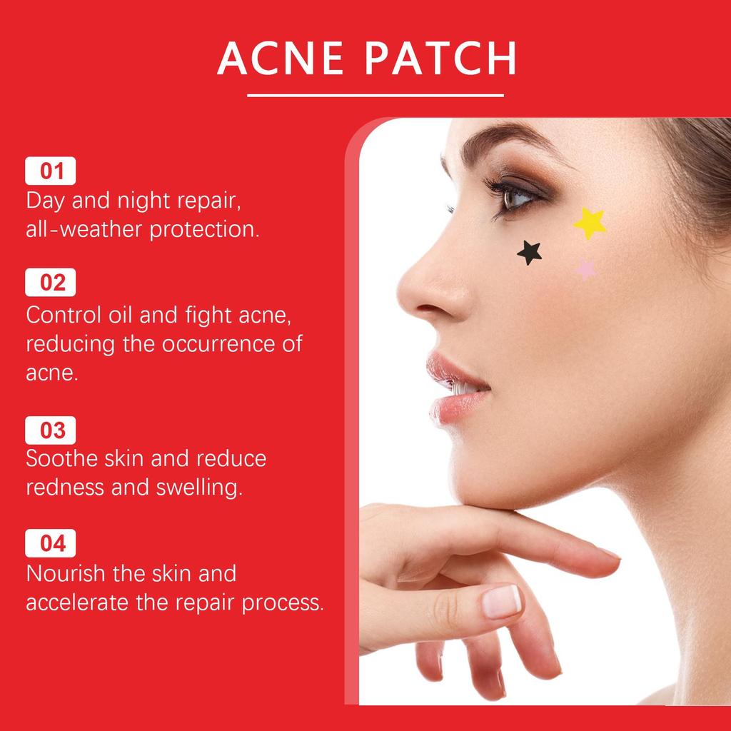 Jaysuing Acne Patches: Top-quality Hydrogel Acne Patches Designed Specifically To Reduce Acne and Whiteheads, 200 Pieces.