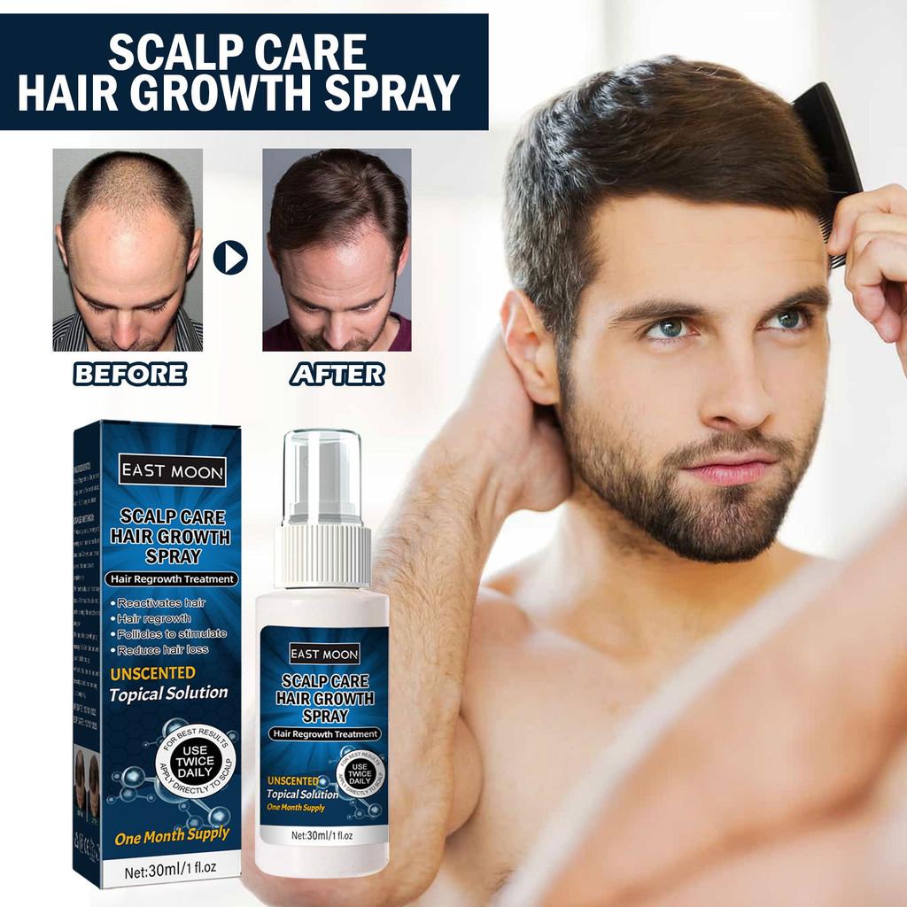 East Moon Men's Hair Growth Spray For Thicker Hairline And Prevents Hair Loss