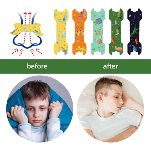 Children's Nasal Strips, Breathing Strips, Nasal Breathing Strips, Anti-Snoring Nasal Strips, Nostril Dilation Tapes, Sleep-Friendly Nasal Strips for