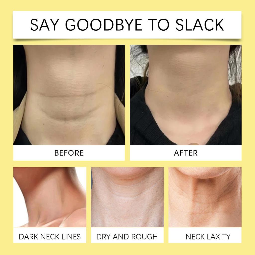 Retinol Neck Moisturizing Cream Neck Skin Care Gentle Moisturizing Hydrating Neck Cream