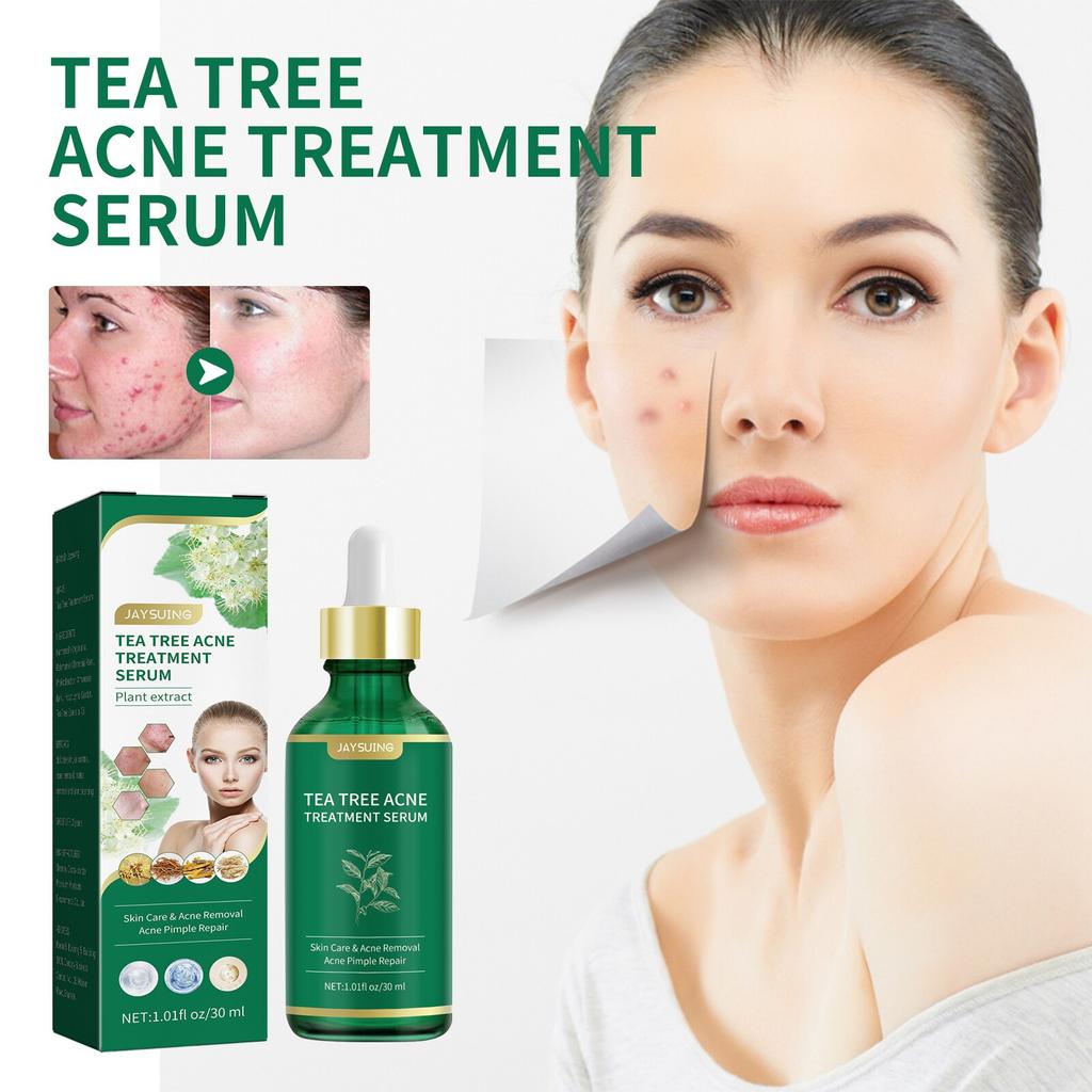 Tea Tree Oil Acne Serum 30ml Moisturizing for All Skin Types Gentle Repair Oil Control Balancing Essence Cream