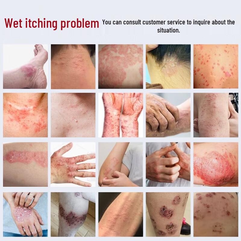 VSEA Herbal Skin Relief Cream