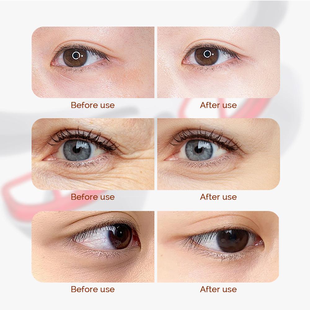 Electric Eye Massager Red Light Relieves Eye Fatigue Eyes Massage Glasses Hot Compress Eye Glasses Massager Dark Circles Remover