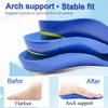 Kids Adult Orthopedic Insoles For Flat Feet High Arch Support Correction OX-Legs Valgus Horseshoe Foot Care Deep Cup Shoes Pads