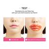 Berrisom - SOS Lippenpflaster 30 Stück - 3 Arten