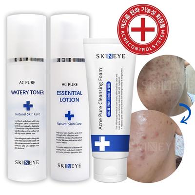 Skineye AC Pure Watery Toner + Essential Lotion Acne Youth Acne Cleansing Foam SET (Basic Acne Skin Care 3 Type Set), 1 Set