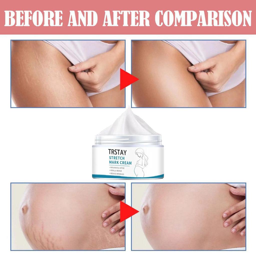 Smoothing Skin Stretch Mark Cream, Gentle and Non-irritating, Smooths Wrinkles and Fades Fine Lines
