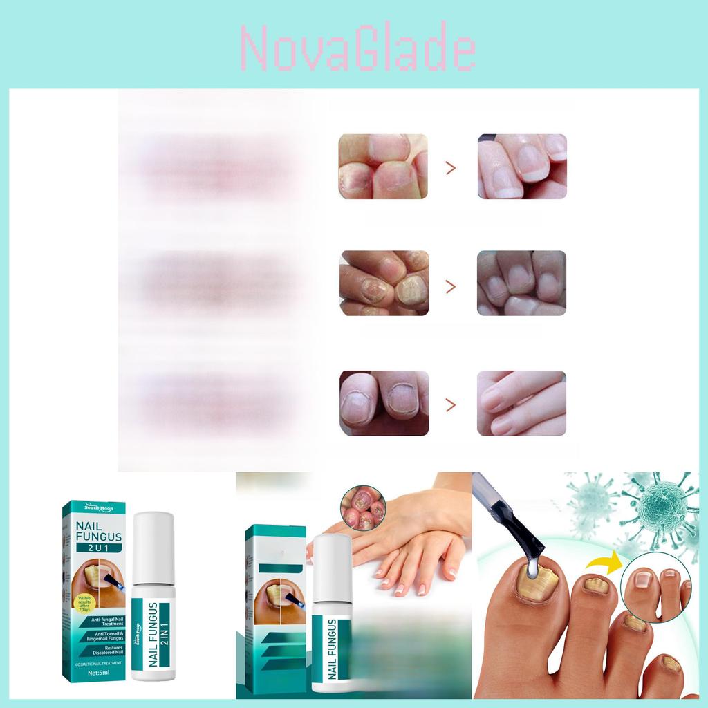 Aukščiausios kokybės nagų prie nagų remonto tirpalas 5 ml spalvos pakitimams ir nagų minkštinimui