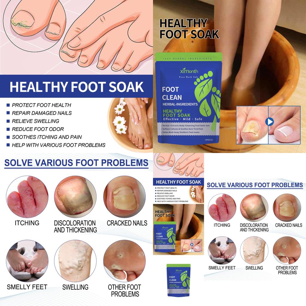 Ximonth Foot Care Pack With Nourishing Ingredients For Softened Skin And Callus Repair
