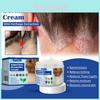 South Moon Seborrheic Dermatitis Cream Effective Relief For Scalp And Skin Problems
